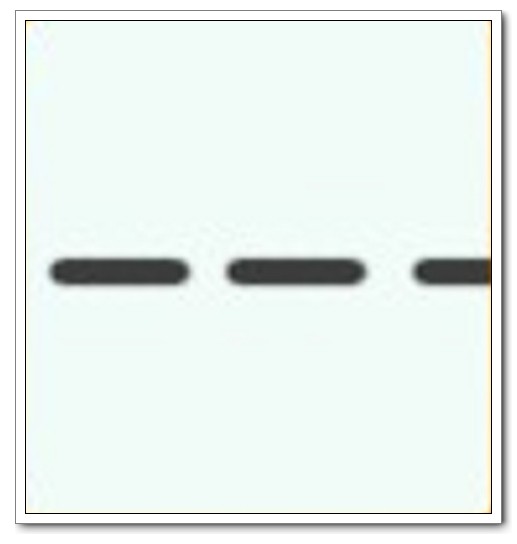 Western Blot